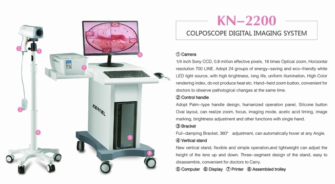 video kolposkop özellikler