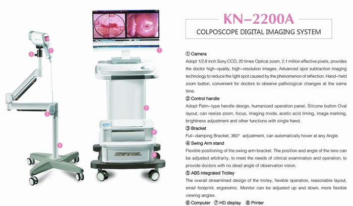 video kolposkop özellikler